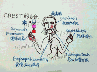 赠李端明