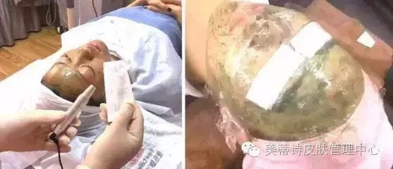从光师求花